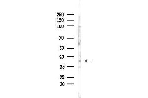 Western blot analysis of lysates from F10-LUC cells(LPS,4h treatment), using NDUF Antibody at 1/1000 dilution.