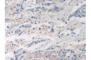 Used in DAB staining on fromalin fixed paraffin- embedded glioma tissue (Factor VIII 抗体  (AA 1887-2044))