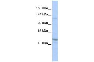KIAA0319L antibody used at 1 ug/ml to detect target protein. (KIAA0319L 抗体  (Middle Region))