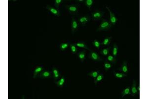 Immunofluorescence analysis of A549 cells using APEX1 antibody. (APEX1 抗体  (AA 1-318))