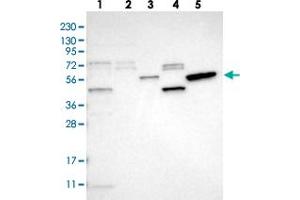 Western blot analysis of Lane 1: RT-4, Lane 2: U-251 MG, Lane 3: Human Plasma, Lane 4: Liver, Lane 5: Tonsil with SLC41A1 polyclonal antibody . (SLC41A1 抗体)