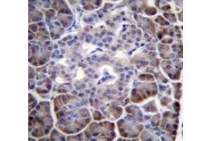 Immunohistochemistry (Paraffin-embedded Sections) (IHC (p)) image for anti-Myosin Binding Protein H-Like (MYBPHL) (AA 87-116), (N-Term) antibody (ABIN953557)