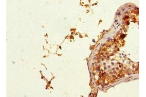 Immunohistochemistry of paraffin-embedded human testis tissue using ABIN7163046 at dilution of 1:100 (PHF11 抗体  (AA 1-292))