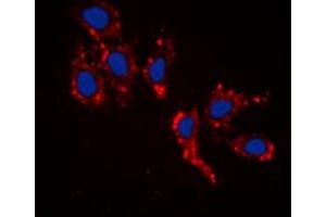 Immunofluorescent analysis of RPL39 staining in HepG2 cells. (RPL39 抗体  (N-Term))