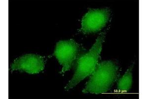Immunofluorescence of monoclonal antibody to STAMBP on HeLa cell. (STAMBP 抗体  (AA 1-424))