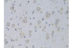 Immunohistochemistry of paraffin-embedded rat brain using GARS antibody (ABIN1876623) at dilution of 1:100 (40x lens). (GARS 抗体)