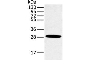 Western blot analysis of Human normal lung tissue using CLDN25 Polyclonal Antibody at dilution of 1:250 (CLDN25 抗体)
