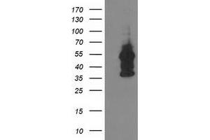 HEK293T cells were transfected with the pCMV6-ENTRY control (Left lane) or pCMV6-ENTRY DOK2 (Right lane) cDNA for 48 hrs and lysed. (DOK2 抗体)