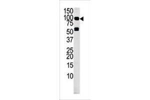 Western blot analysis of anti-RK4 Pab (ABIN391222 and ABIN2841295) in mouse liver tissue lysate (35 μg/lane). (MARK4 抗体  (C-Term))