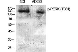 Western Blot analysis of 453(1), AD293(2), diluted at 1:2000. (PERK 抗体  (pThr981))