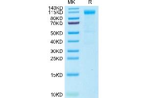 CD22 Molecule (CD22) (AA 20-686) protein (His tag)