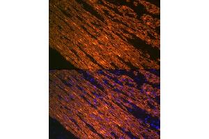 Immunofluorescence analysis of smooth muscle of human colon carcinoma using α-Smooth Muscle Actin  Rabbit mAb (ABIN7265392) at dilution of 1:100 (40x lens). (Smooth Muscle Actin 抗体)