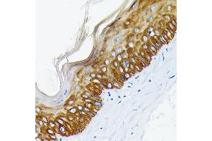 Immunohistochemistry (IHC) image for anti-Keratin 14 (KRT14) antibody (ABIN7268091)