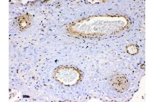 IHC testing of FFPE human placenta tissue with VEGFR2 antibody at 1ug/ml. (VEGFR2/CD309 抗体)