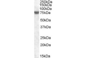 Image no. 1 for anti-Fem-1 Homolog A (FEM1A) (C-Term) antibody (ABIN375131) (FEM1A 抗体  (C-Term))