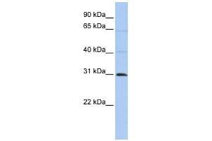 C1ORF184 antibody used at 1 ug/ml to detect target protein. (METTL11B 抗体  (C-Term))