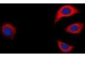Immunofluorescent analysis of GAB1 staining in K562 cells. (GAB1 抗体  (C-Term))