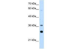 RPLP0 antibody used at 2. (RPLP0 抗体  (Middle Region))