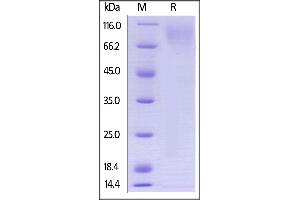 SDS-PAGE (SDS) image for Carcinoembryonic Antigen-Related Cell Adhesion Molecule 1 (CEACAM1) (AA 35-428) protein (His tag,AVI tag,Biotin) (ABIN3137678)