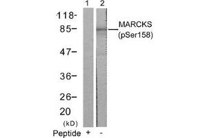 Western blot analysis of extracts from 3T3 cells using MARCKS(Phospho-Ser158) Antibody(Lane 2) and the same antibody preincubated with blocking peptide(Lane1).