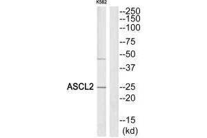 Western blot analysis of extracts from K562 cells, using ASCL2 antibody. (ASCL2 抗体)