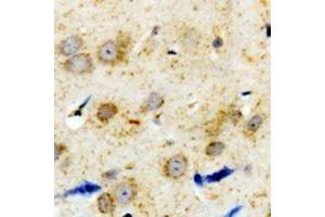 Immunohistochemical analysis of Alpha-1A Adrenergic Receptor staining in human brain formalin fixed paraffin embedded tissue section. (alpha 1 Adrenergic Receptor 抗体  (C-Term))
