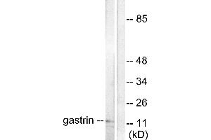 Western blot analysis of extracts from NIH/3T3 cells, using Gastrin antibody (#C0205). (Gastrin 抗体)