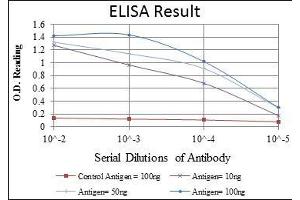 Red: Control Antigen (100 ng), Purple: Antigen (10 ng), Green: Antigen (50 ng), Blue: Antigen (100 ng), (JUP 抗体)