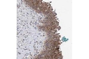 Immunohistochemical staining of human urinary bladder with PFAS polyclonal antibody  shows moderate cytoplasmic positivity in urothelial cells.