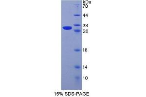 SDS-PAGE analysis of Mouse CRISP1 Protein. (CRISP1 蛋白)