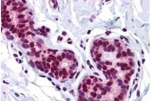 Human Breast: Formalin-Fixed, Paraffin-Embedded (FFPE) (FOXO3 抗体  (N-Term))