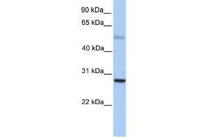 WB Suggested Anti-MXD1 Antibody Titration:  0. (MXD1 抗体  (N-Term))