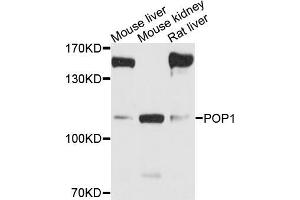 Western blot analysis of extracts of various cell lines, using POP1 antibody (ABIN5973549) at 1/1000 dilution. (POP1 抗体)