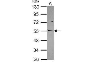 WB Image Sample (30 ug of whole cell lysate) A: NT2D1 10% SDS PAGE antibody diluted at 1:1000 (MMP13 抗体)