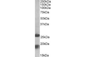 ABIN571250 (2µg/ml) staining of Human Frontal Cortex lysate (35µg protein in RIPA buffer). (MPV17 抗体  (Internal Region))