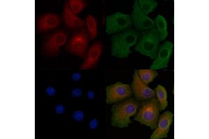 ABIN6260457 and ABIN6278556 staining Hela cells by IF/ICC.