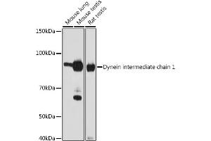 Western blot analysis of extracts of various cell lines, using Dynein intermediate chain 1 antibody (ABIN1681261, ABIN7101535, ABIN7101536 and ABIN7101537) at 1:1000 dilution. (DNAI1 抗体)