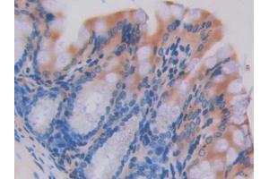 Used in DAB staining on fromalin fixed paraffin- embedded intestine tissue (HEXB 抗体  (AA 294-435))