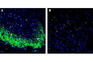 anti-Serotonin Receptor 1D (HTR1D) (AA 14-27), (Extracellular) antibody