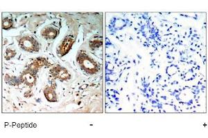 Image no. 1 for anti-14-3-3 zeta (YWHAZ) (pSer58) antibody (ABIN196916) (14-3-3 zeta 抗体  (pSer58))