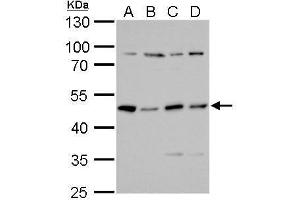 WB Image PKA R2 antibody detects PKA R2 protein by Western blot analysis. (PRKAR2A 抗体  (Center))