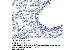 Human Lung (ZNF16 抗体  (N-Term))