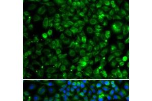 Immunofluorescence analysis of MCF-7 cells using TMLHE Polyclonal Antibody (TMLHE 抗体)