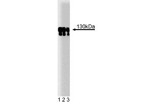 Western blot analysis of p130 [Cas] on a human endothelial cell lysate. (BCAR1 抗体  (AA 644-819))