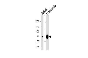 Western blot analysis of lysates from Jurkat cell line and human placenta tissue lysate (from left to right), using LIMK2 Antibody (C-term) (ABIN1881499 and ABIN2843267). (LIMK2 抗体  (C-Term))