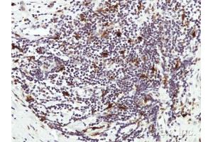 IHC-P Image Immunohistochemical analysis of paraffin-embedded Human lymph tissue, using HICE1 , antibody at 1:50 dilution. (NYS48/HAUS8 抗体)