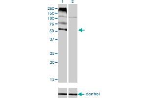 Western blot analysis of FLVCR over-expressed 293 cell line, cotransfected with FLVCR Validated Chimera RNAi (Lane 2) or non-transfected control (Lane 1).