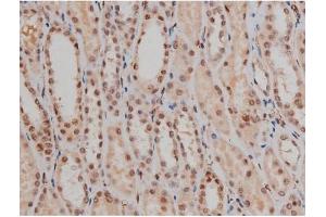 Immunohistochemistry (IHC) image for anti-Sp1 Transcription Factor (SP1) (pThr453) antibody (ABIN6256566)