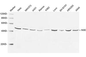 Western blot analysis of cell lysates using 1 µg/mL Rabbit Anti-NSE Polyclonal Antibody (ABIN398879) The signal was developed with IRDyeTM 800 Conjugated Goat Anti-Rabbit IgG. (ENO2/NSE 抗体  (N-Term))