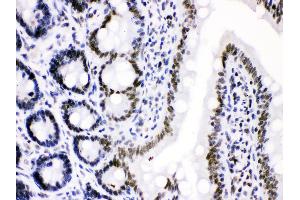 Anti- Cdk9 Picoband antibody, IHC(P) IHC(P): Rat Intestine Tissue (CDK9 抗体  (AA 141-372))